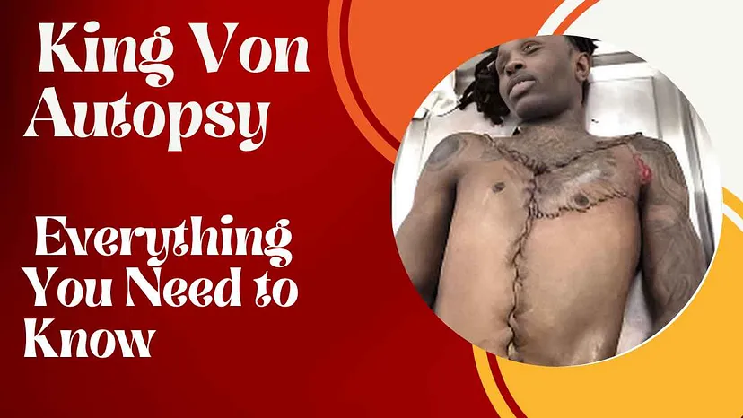 King Von Autopsy